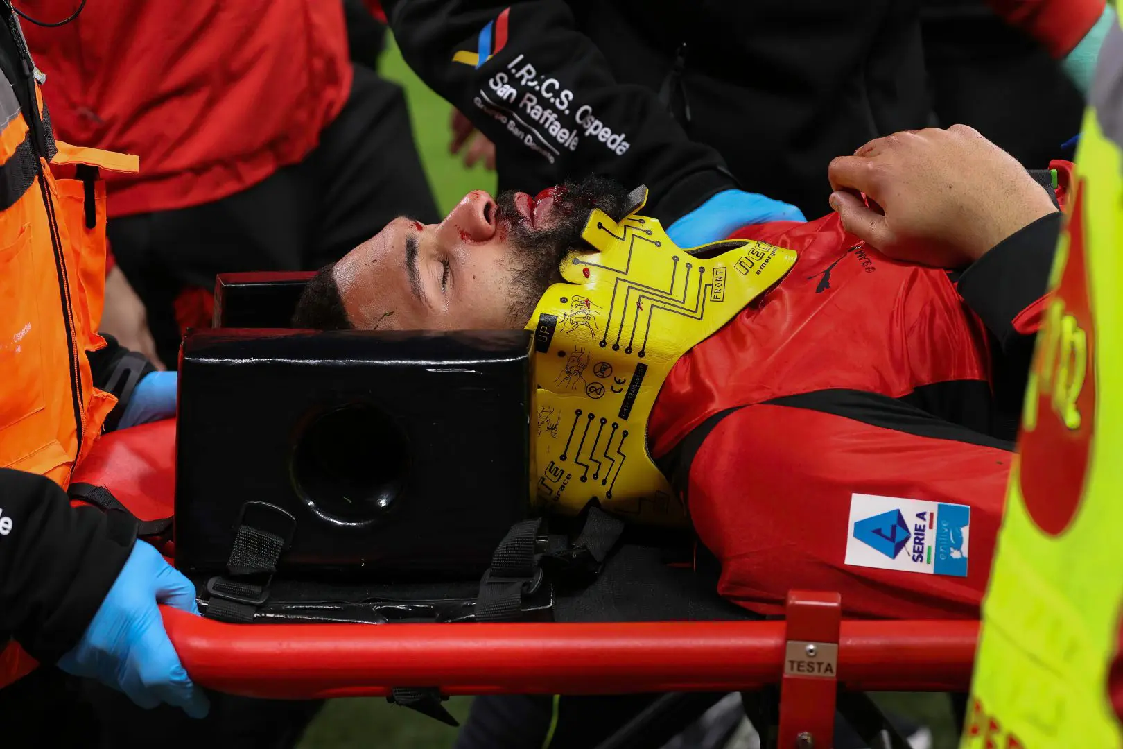 Milan, intervento riuscito per Loftus Cheek: otto settimane di stop. Il giocatore: “Il peggio è alle spalle”